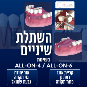 Рекламный баннер для стоматологии OralOra. Услуги по имплантации ALL-ON-4 | ALL-ON-6