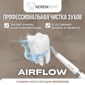 Рекламный баннер для Kerem Dent — профессиональная чистка зубов AirFlow