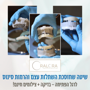 Рекламный баннер для OralOra — базальная имплантация без костной пластики и синус-лифта