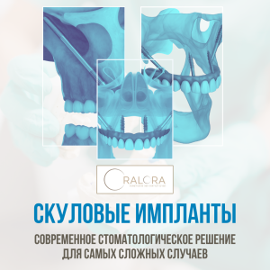 Рекламный баннер для OralOra — скуловые импланты